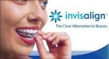 Invisalign